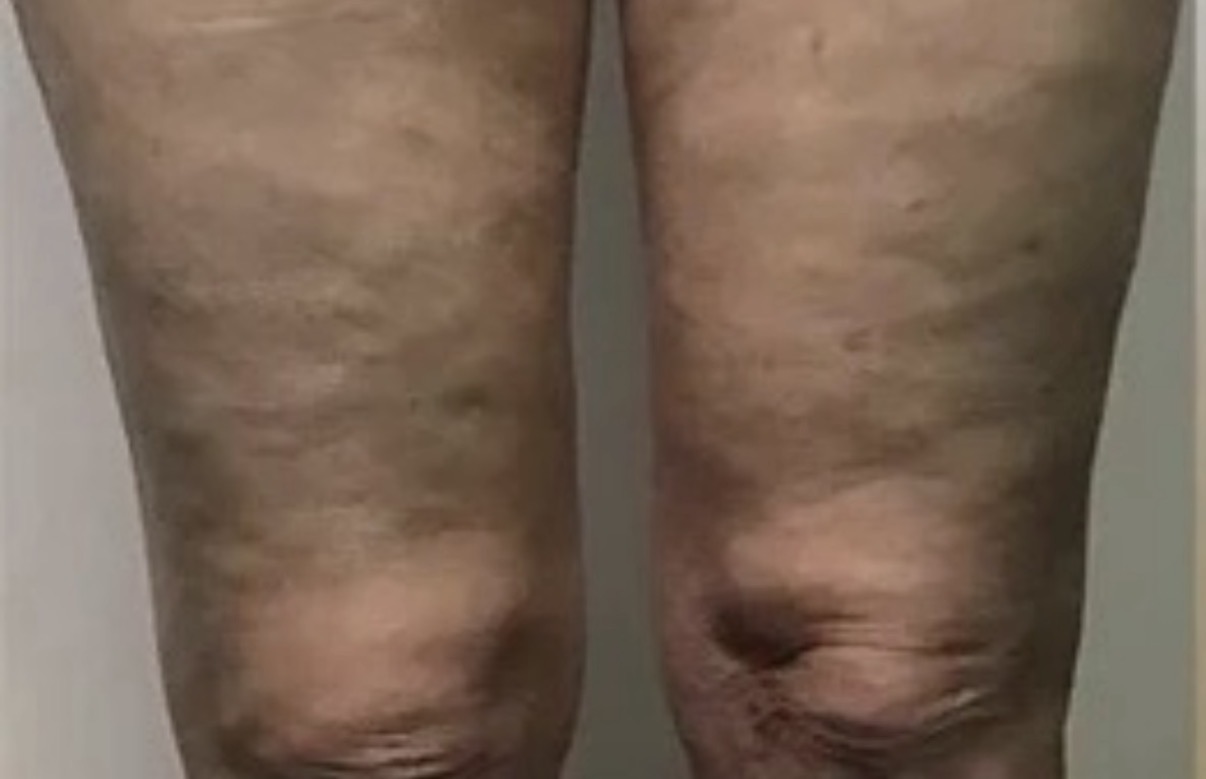 قبل